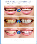 Charger l'image dans la galerie, DENTIFRICE BLANCHISSANT DENTAIRE  - élimine les taches de fumée, les taches de café, les caries et la mauvaise haleine
